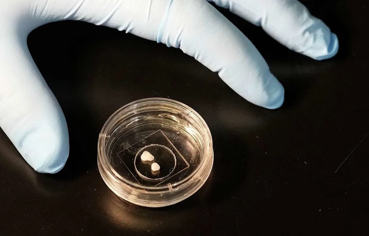 Mini-mozgovi iz laboratorije: UTHealth traži odgovore na misteriju shizofrenije