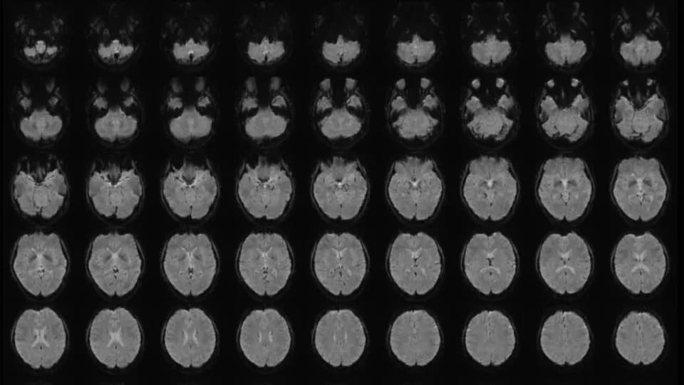 Mind‑captioning: japanski naučnik prevodi mentalne slike u rečenice — veliki napredak, ozbiljne etičke dileme