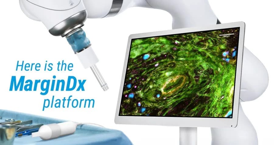 Sonda i robotska ruka iz Ilinoisa: nova šansa za smanjenje ponovnih operacija kod raka