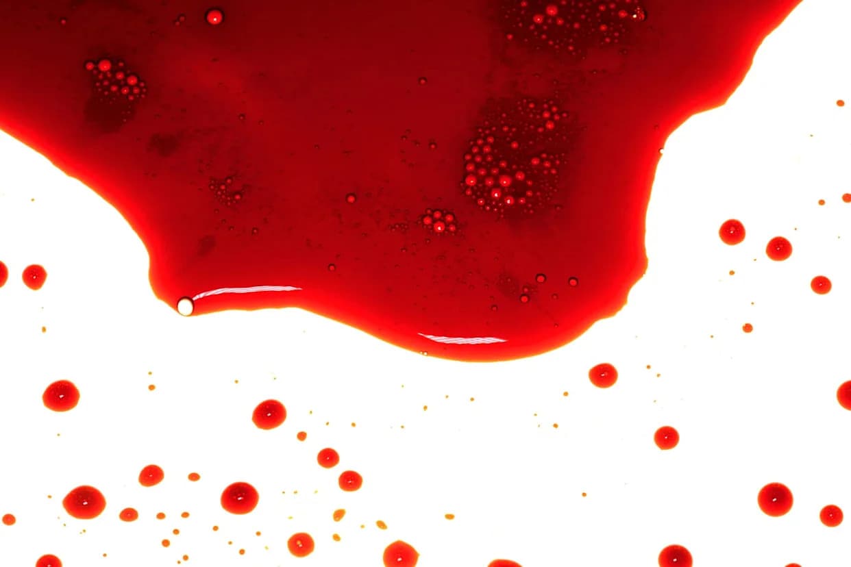 Novi Izuzetno Redak Krvni Tip B(A) Otkriven — Samo Tri Poznata Slučaja