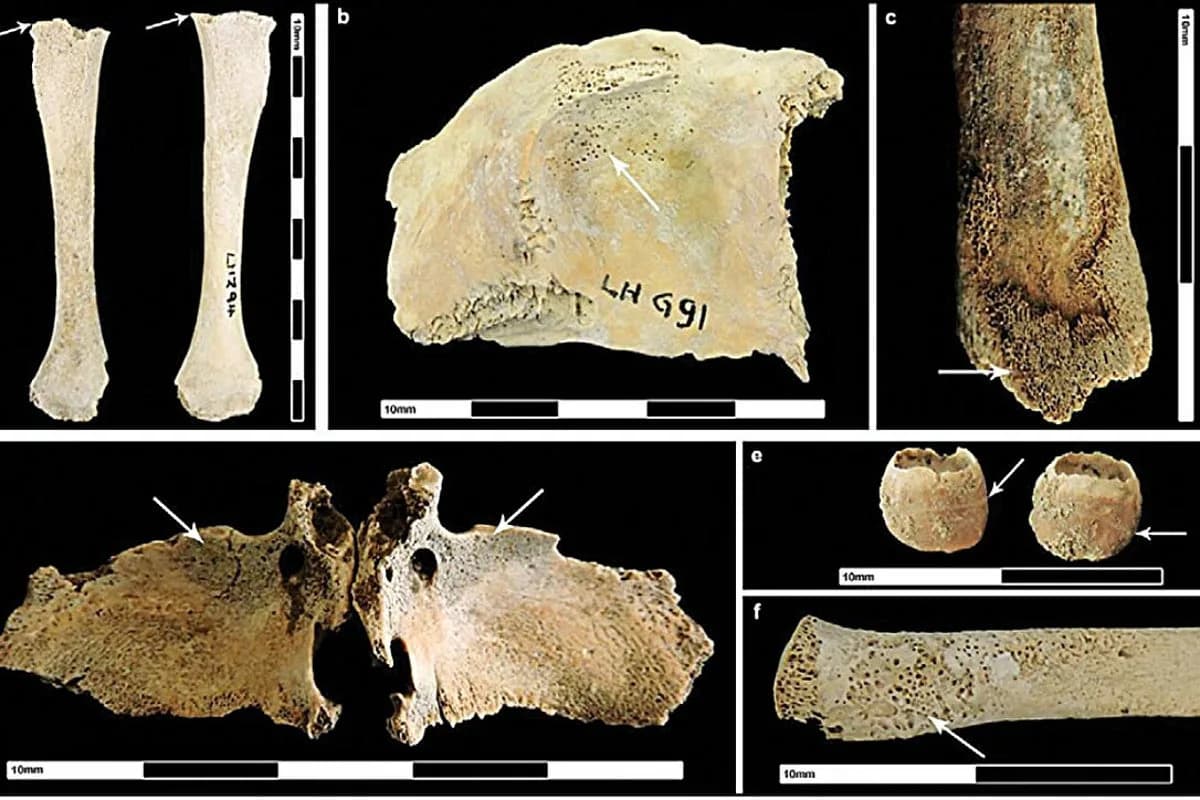 Rimska okupacija pojačala bolesti u britanskim gradovima, ukazuju arheolozi