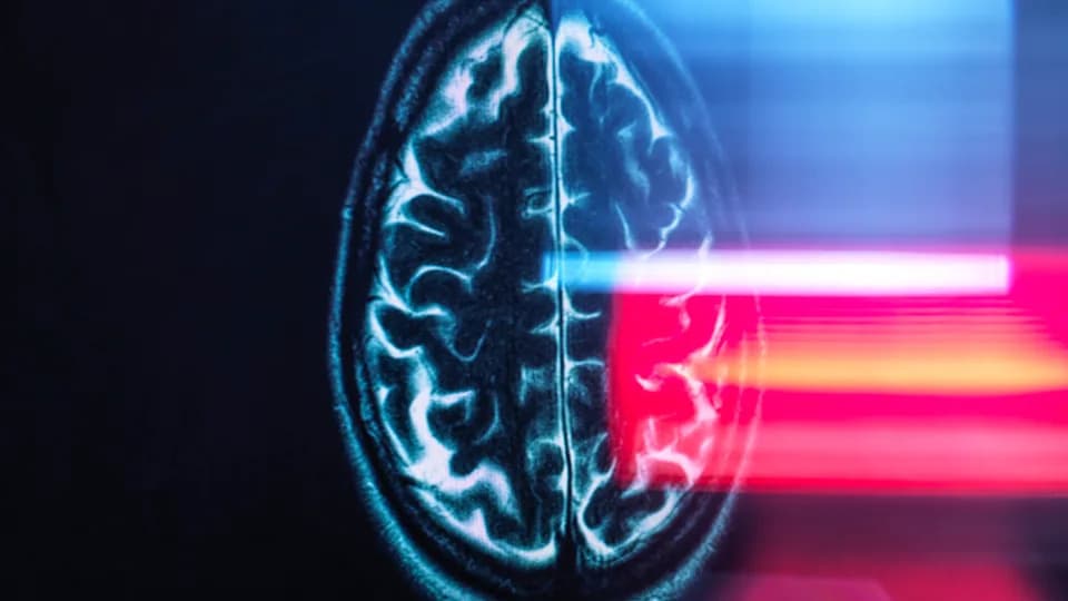 Mozak Ima „prekidač“ za Novinu i Poznatost — Otkriven Gradijent u Hipokampusu Koji Objašnjava Zašto Se Gubimo Ranije Kod Demencije