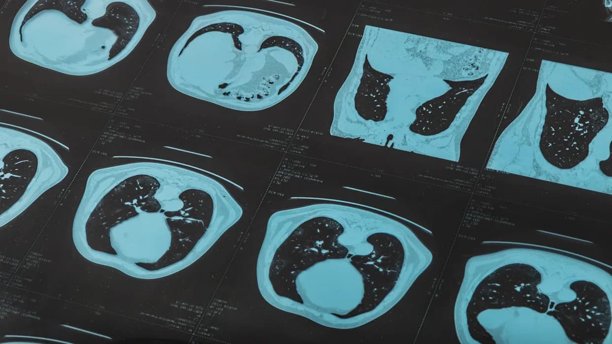 „Bombastične“ Kritike: Naučnici Preispituju Nekoliko Studija O Mikroplastici U Ljudskom Telu