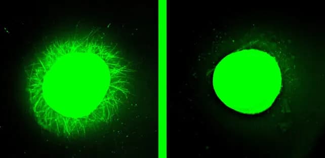 Naučnici Uzgajili Mini Ljudske Kičmene Moždine — Terapija IKVAV-PA Podstiče Regeneraciju Posle Povrede