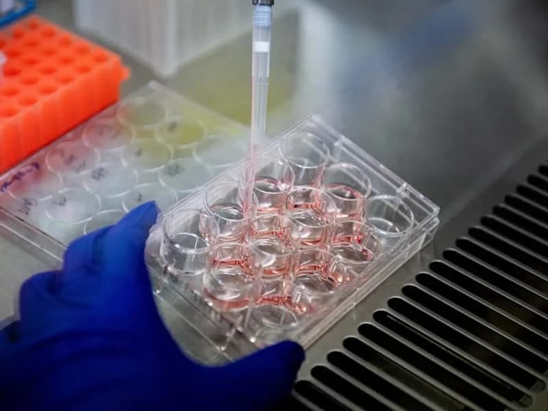 „Vratar” Ispod Membrane: Kako Rešetka Neurona Može Smanjiti Rizik Od Alchajmera