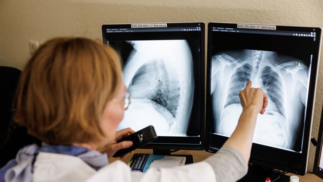 Alarmantni Podaci: 41.472 Novoobolela i 20.314 Preminulih Od Raka U Srbiji (2024) — Poziv Na Nacionalni Program Prevencije