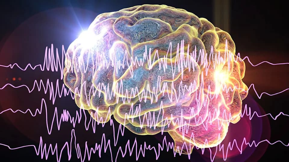 San Posle Napada Može „Zapamtiti“ Epilepsiju — Studija Predlaže Personalizovanu Električnu Stimulaciju