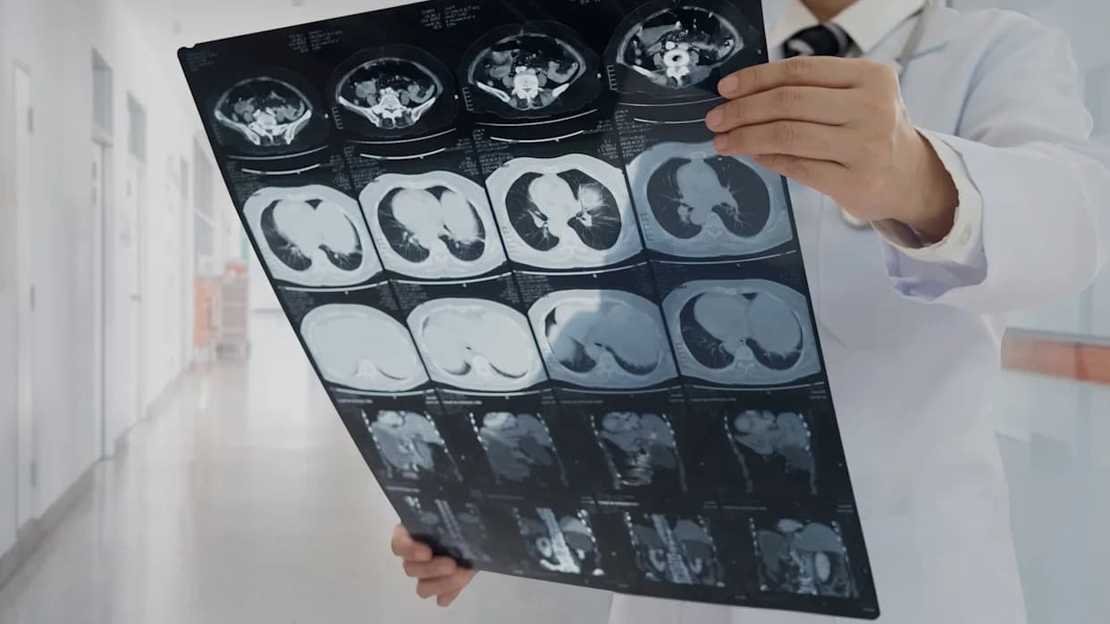 Najsitnije Nanoplastike Mogu Ozbiljno Oštetiti Bubrege — Šta Novo Istraživanje Pokazuje