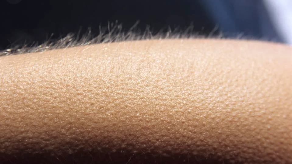 Zašto Nam Se Javlja Gusja Koža? Nauka O Refleksu Koji Je Preživeo Evoluciju