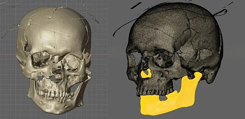 Iz Groba 'Vampira': Arheolozi U Hrvatskoj Rekonstruisali Lice Muškarca Starog Više Od 400 Godina