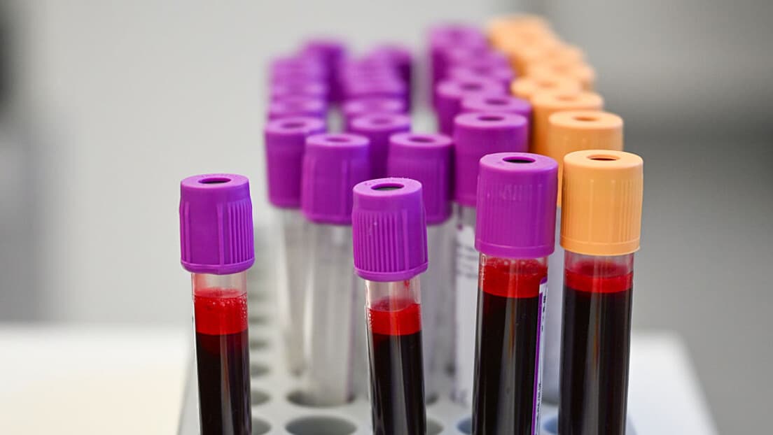 Alarmantno u Varešu: Olovo U Krvi Kod Više Od 300 Stanovnika, Roditelji Zahtijevaju Hitno Testiranje