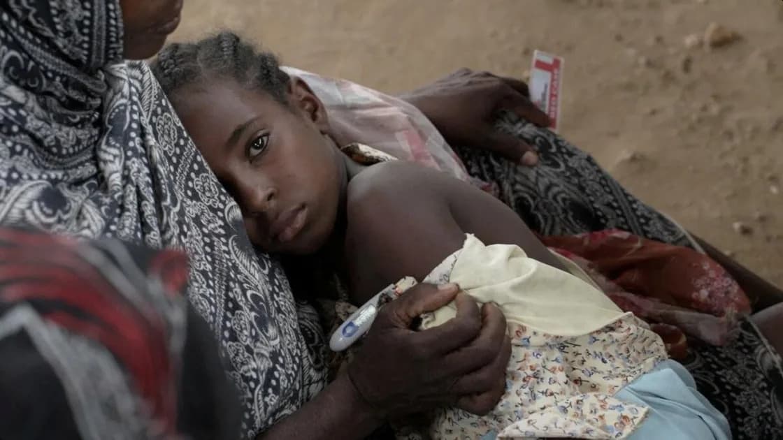 Smrtonosna epidemija ospica u Darfuru: Kako rat i kolaps zdravstva ubijaju decu