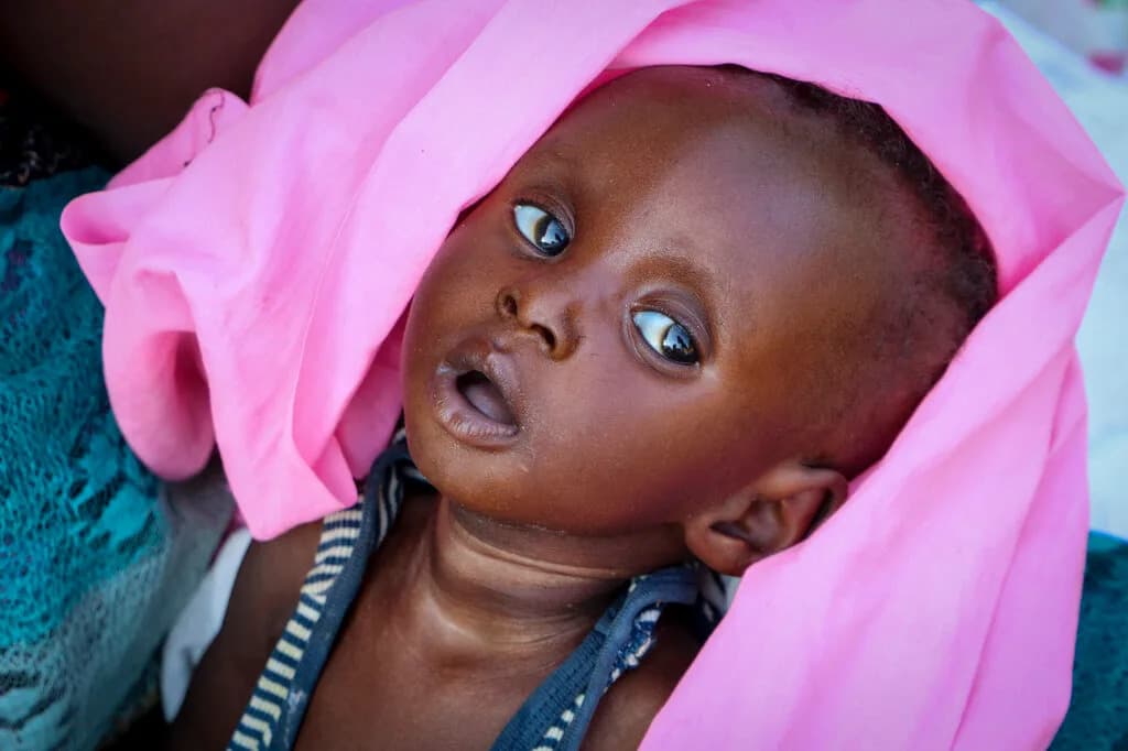 Skoro 8 miliona ljudi u opasnosti: Južni Sudan na ivici humanitarne katastrofe