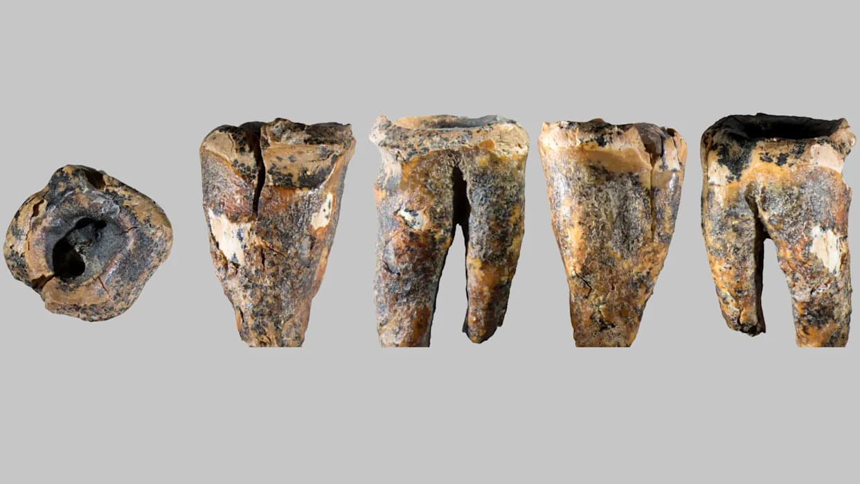 Neandertalci 'stomatolozi': Lečili Karijes Pre Oko 59.000 Godina