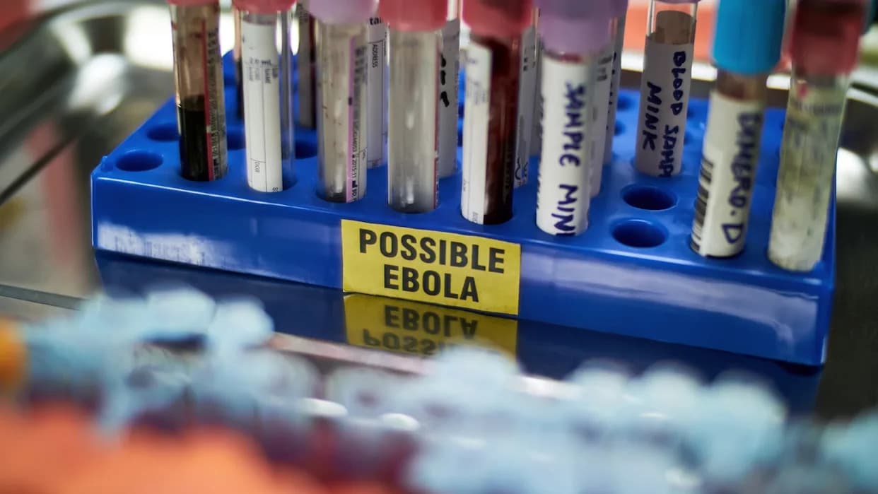 Dezinformacije Podstiču Napade Na Bolnice U Kongu Dok Se Širi Epidemija Ebole