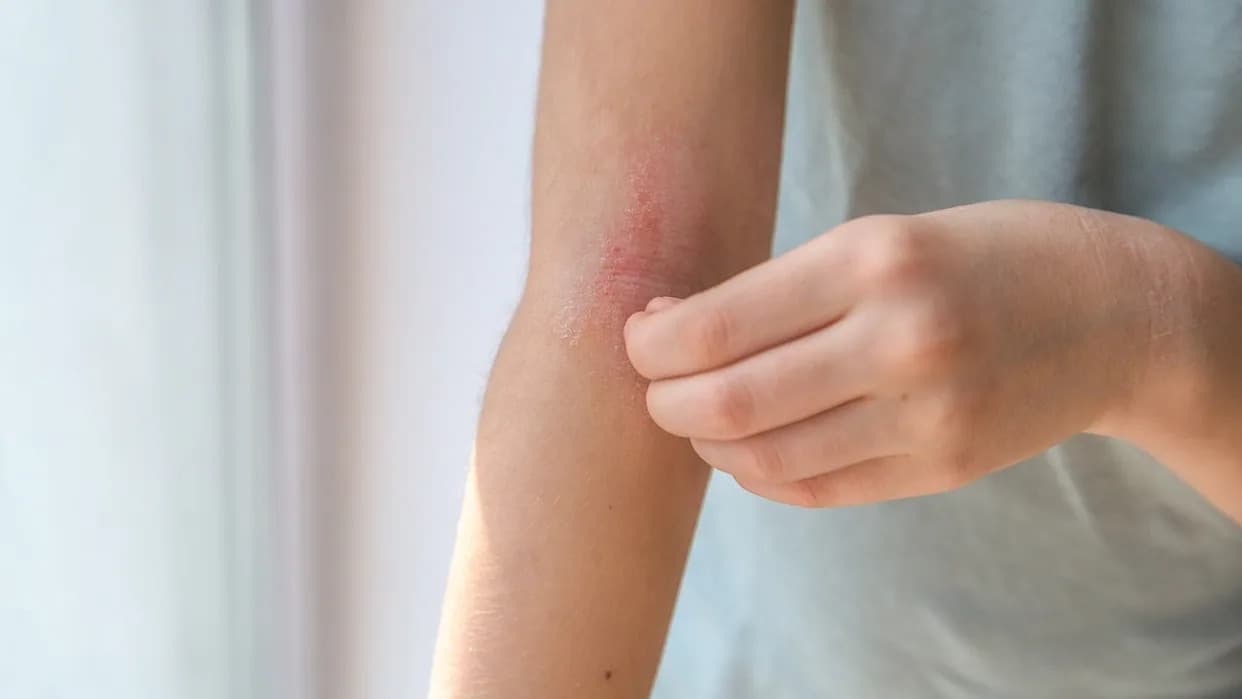 MHRA odobrila EURneffy 1 mg — prvi bezigleni adrenalin za decu (4+) u Velikoj Britaniji