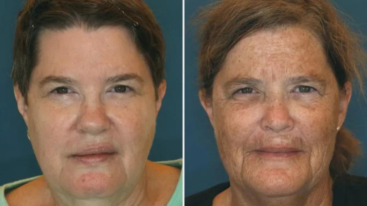 Provera činjenica: Prave fotografije blizanaca pokazuju efekat sunca — nisu dokaz 16 godina pušenja