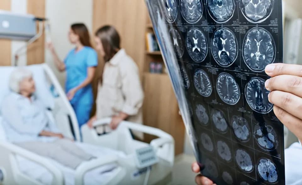 Novo istraživanje: Amiloid beta istiskuje tau sa mikrotubula — mogući rani okidač Alzheimera
