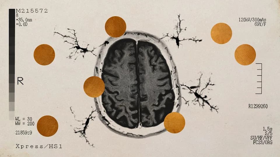 Bakarni spoj Cu(ATSM) poboljšava pamćenje kod miševa i smanjuje amyloid‑beta — nada za nove terapije Alchajmera