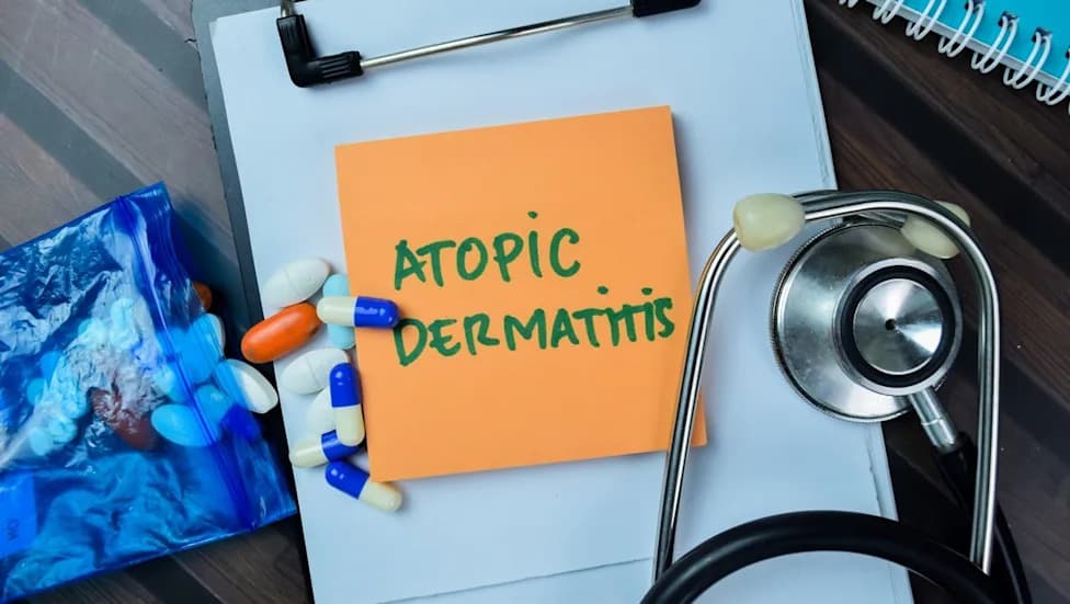 Organon: Vtama krema pokazala brzo i postojano poboljšanje kod atopijskog dermatitisa u svim uzrastima