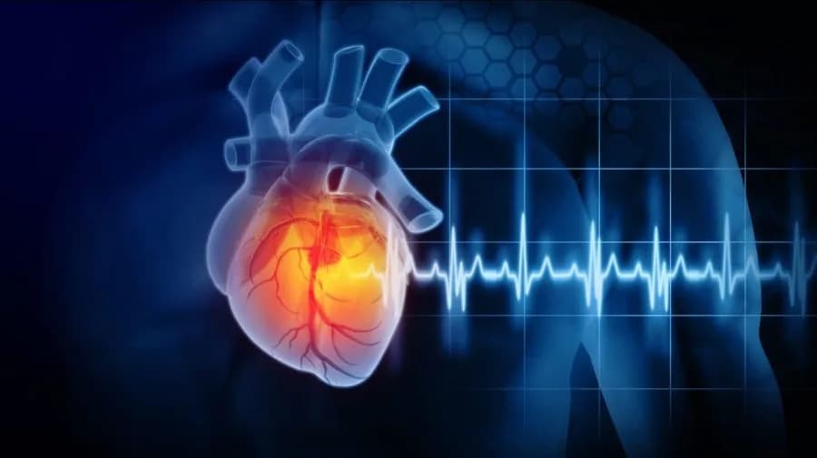 Alarmantna studija: Mikroplastika pronađena u krvi 84% pacijenata sa teškim infarktom