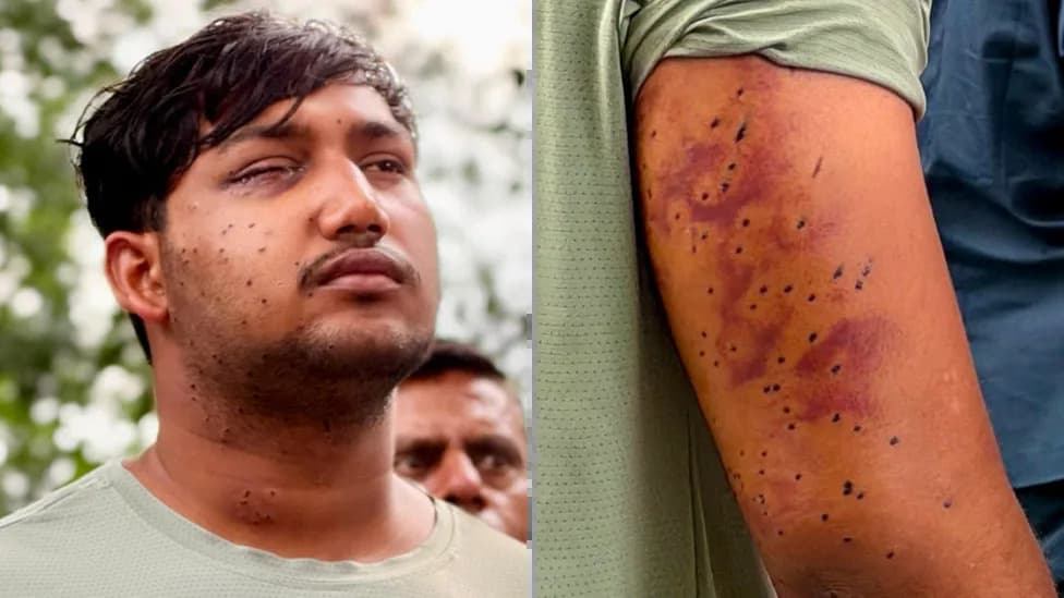 Eksperti: Povrede kod demonstranata u Delhiju ukazuju na ranjavanja od patron‑puški