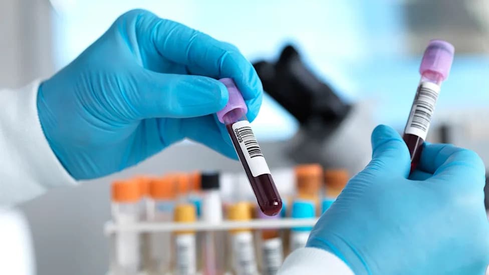 Engleska Na Korak Do Eliminacije Hepatitisa C: Šta To Znači Za Javnost