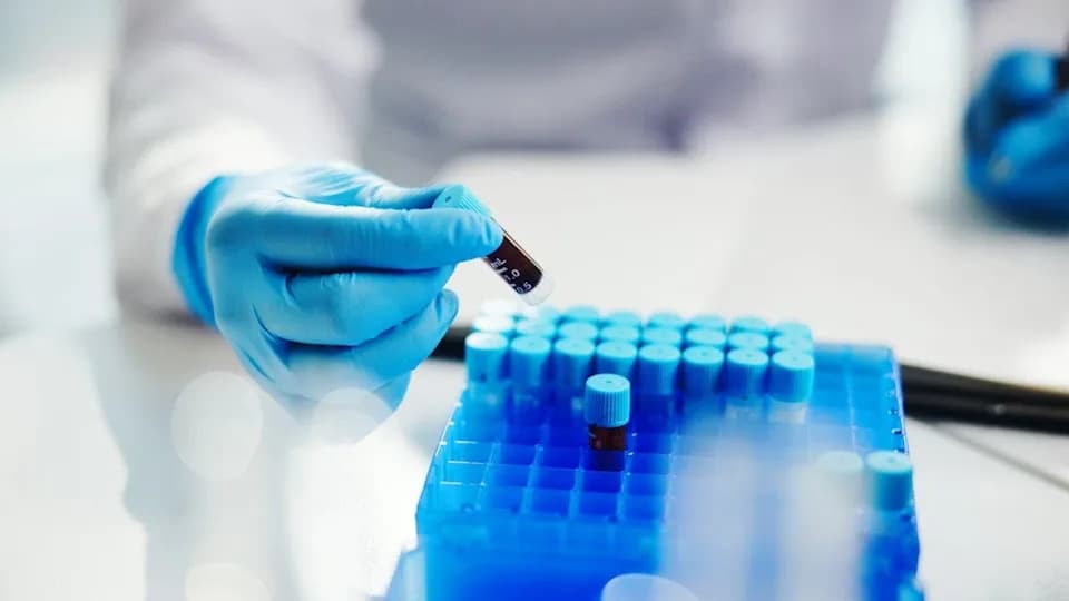 DNK Može Predvideti Progresiju Krvnih Karcinoma Godinama Pre Rutinskih Testova