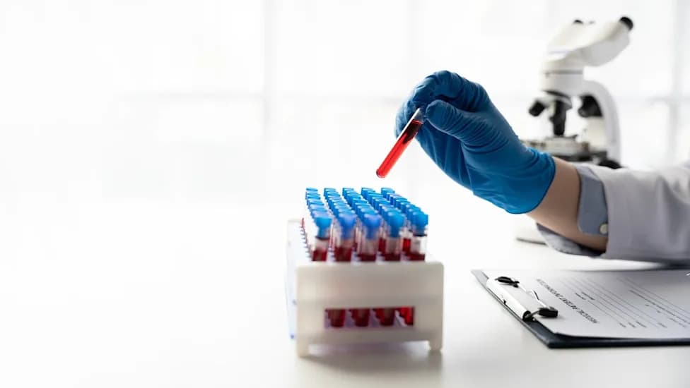 Fate Therapeutics Pokreće Fazu II Studije RECLAIM‑LN: FT819 Za Lupus Nefritis