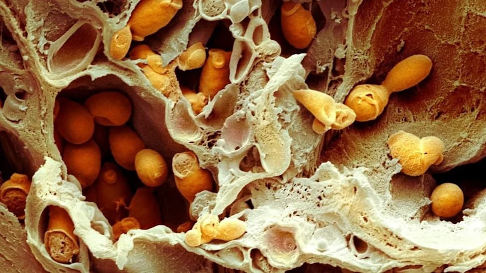Novo Otkriće Protiv Opasnih Gljivičnih Infekcija: Bakterijski Antibiotik Gladiolin Može "Umiriti" Candida albicans