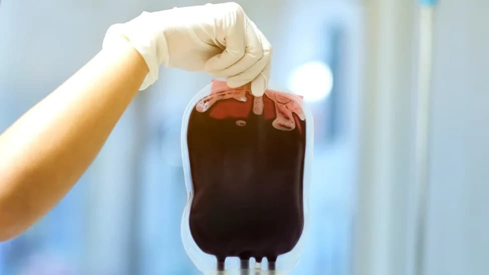 Može Li Se Alchajmer Preneti Transfuzijom Krvi? Novi Pregled Istraživanja
