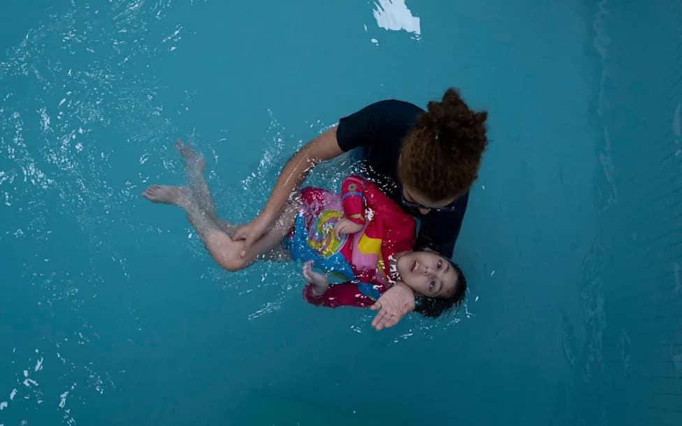 Deset Godina Posle Zike: „Zika Bebe“ Suočene Sa Novim Teškim Komplikacijama
