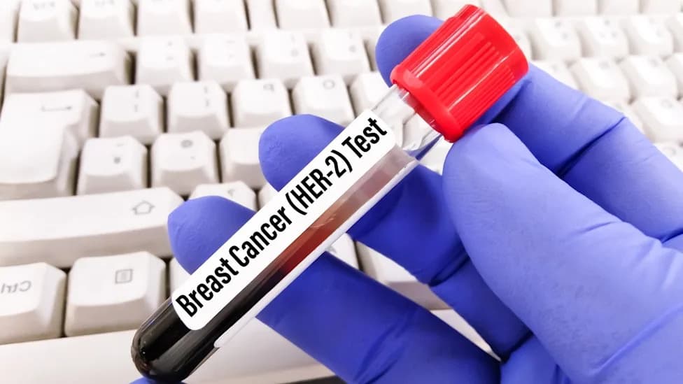 FDA Odobrila Ziiheru Za Prvu Liniju Lečenja Naprednog HER2+ GEA