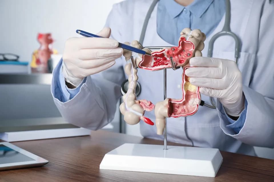 Velika studija: Rak debelog creva pre 50. godine ima drugačiju biologiju i povoljniji ishod kod metastaza u jetri
