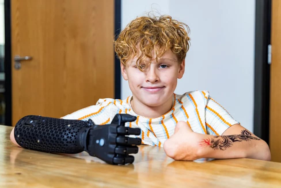 Hero PRO: 11-godišnji Fin iz Hereforda Dobio Naprednu Bioničku Ruku Pre Polaska U Srednju Školu