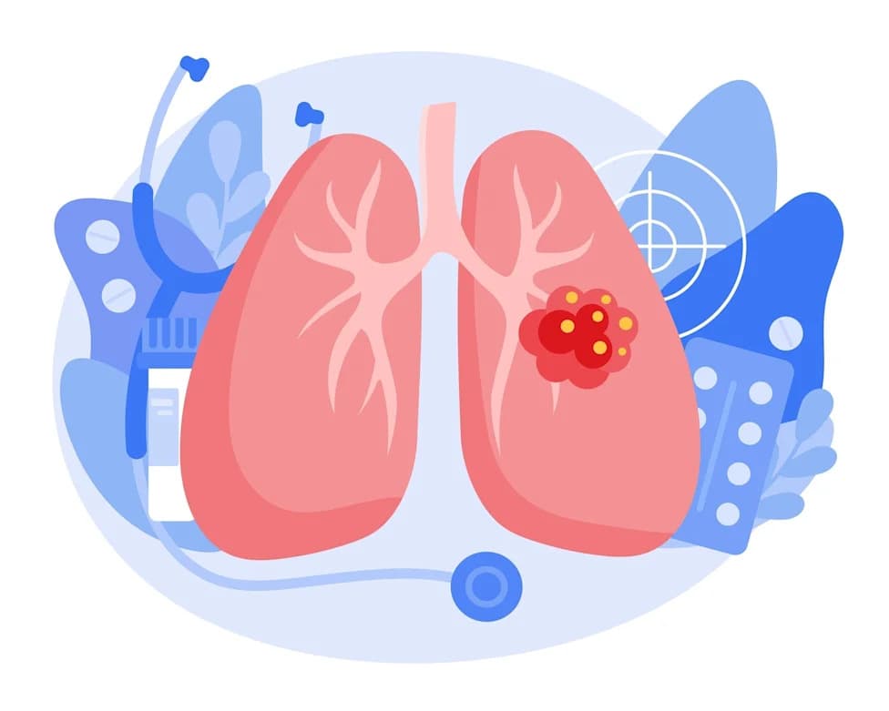 Bayerov Hyrnuo (sevabertinib) dobio ubrzano FDA odobrenje za prvu liniju lečenja HER2‑mutantnog NSCLC‑a — ORR 75% u SOHO‑01