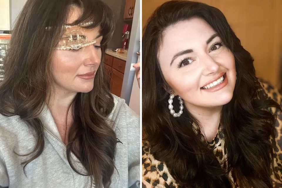 Devet Godina Glavobolja — Jedan TikTok-komentar Promenio Je Sve