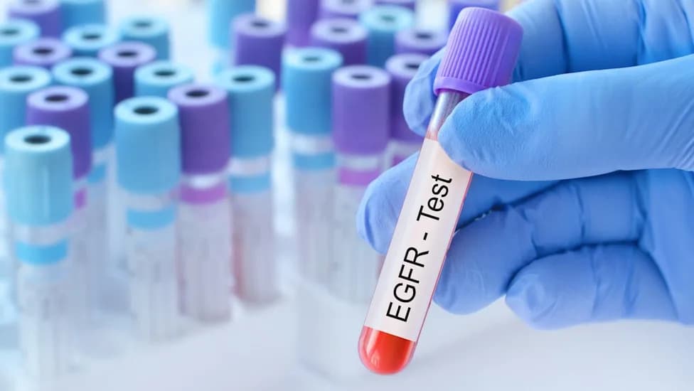 REZILIENT3: Zipalertinib u Kombinaciji Sa Hemoterapijom Značajno Produžava PFS Kod NSCLC Sa EGFR ex20ins