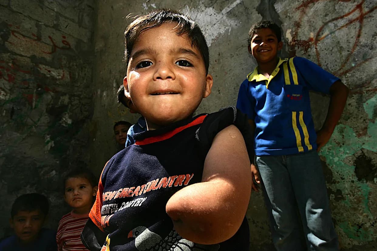 Improvizovane proteze u Gazi: cevi i kanap vraćaju pokretljivost deci i odraslima