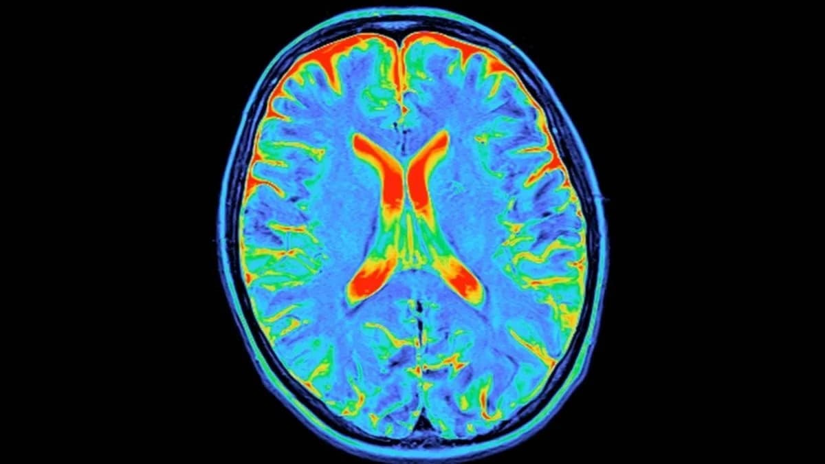 Vaš mozak kroz pet epoha: veliko istraživanje otkriva četiri ključne prekretnice