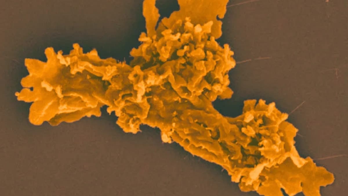 Vatrena ameba ruši granice: eukariot koji raste pri 63 °C
