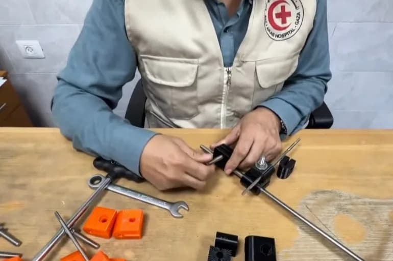 Kako lekari u Gazi koriste 3D štampu i solarnu energiju da spasu polomljene udove