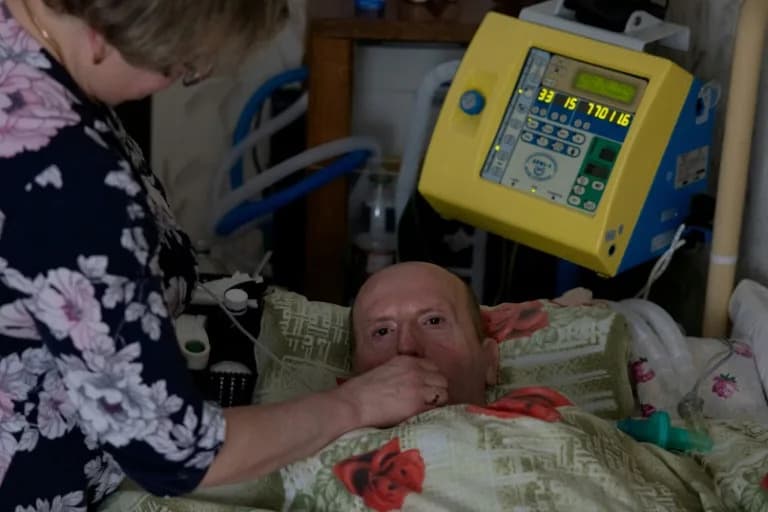 Svaki nestanak struje može biti koban — supruga iz Černigiva bori se da održi život supruga sa ALS-om