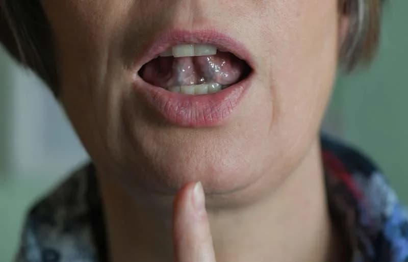 AI Test Iz Pljuvačke: Korejski Senzor Za Rano Otkrivanje Parkinsonove I Drugih Neuroloških Poremećaja