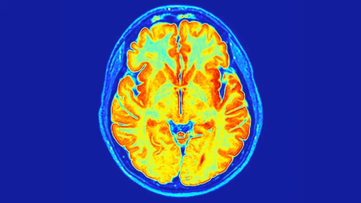 Otkriven ReNU2: Novi Recesivni Neurorazvojni Sindrom Povezan Sa Genom RNU2-2