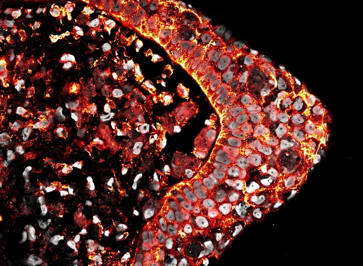 Zašto ljudi ne mogu da regenerišu udove? Novo istraživanje ističe ulogu hijalurona i kiseonika