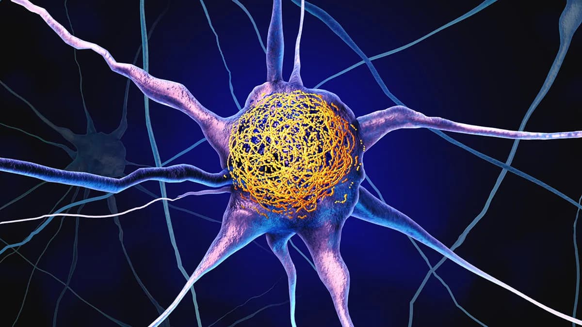 Viši nivo vitamina D u srednjem dobu povezan s manjim nakupljanjem tau proteina, pokazuje studija