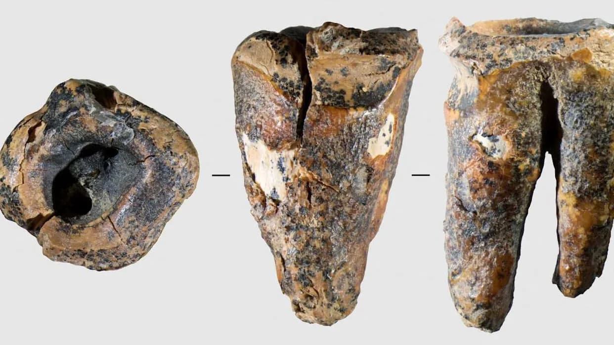 Neandertalski Zub Star 59.000 Godina Otkriva Najstariju Poznatu Stomatološku Intervenciju