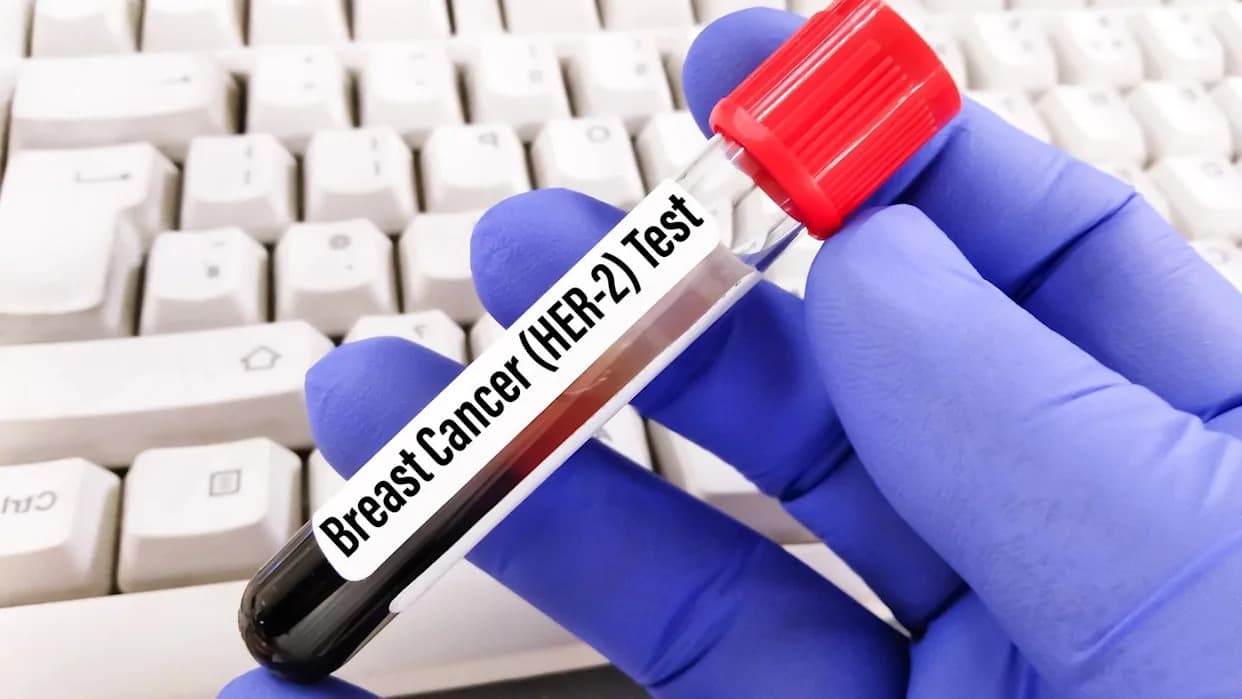Rocheov giredestrant dobio prioritetnu reviziju FDA — potencijalni novi standard u lečenju ranog ER+ raka dojke