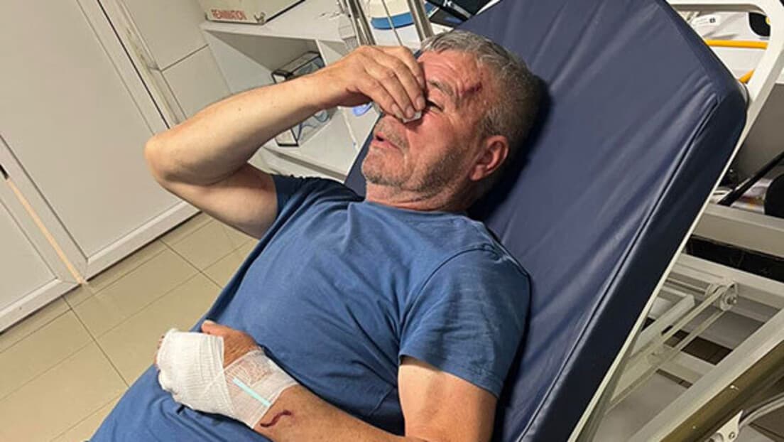 Pretučen Srbin iz Binača: Branio Sina, Napadač Ga Udario Drvetom i Pobegao